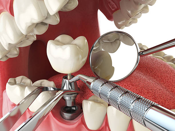 Best Broken or Cracked Tooth Emergency Dentist in Midland, PA